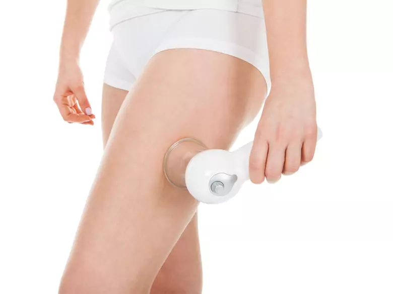 Zwalcz cellulit laserem