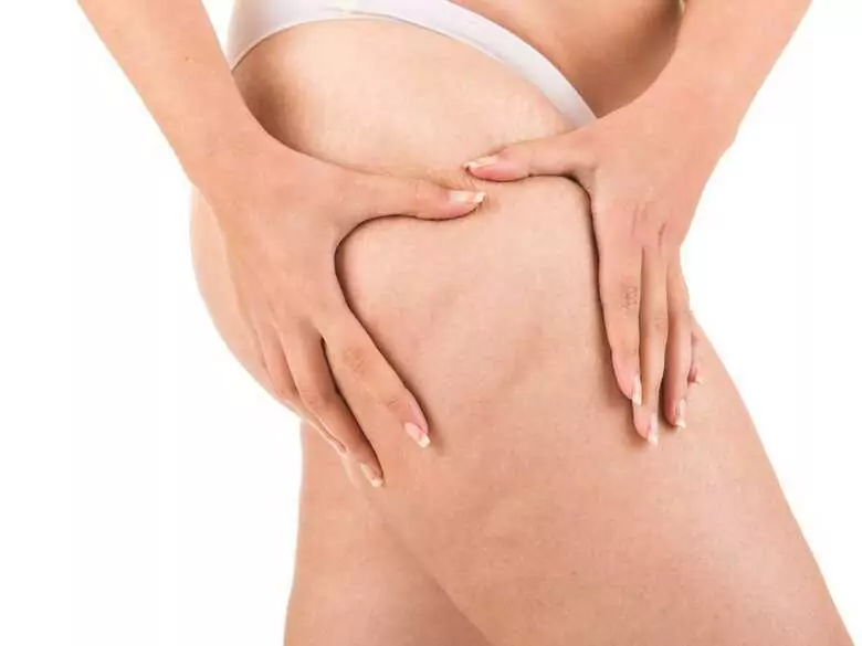 Lipodemia - choroba „grubych nóg”