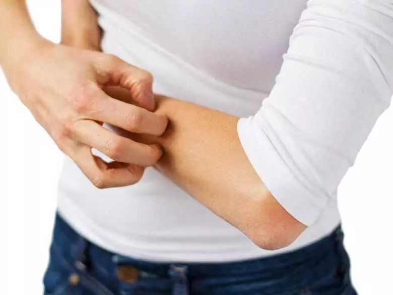 Pękająca skóra rąk po użyciu płynu do mycia naczyń – czy to już alergia?