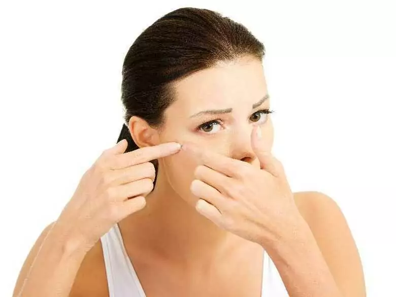 Terapia hormonalna u kobiet z trądzikiem