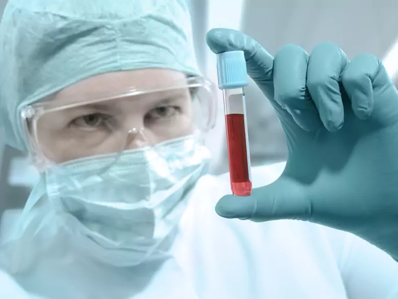 Wampirzy lifting – panaceum na starość?