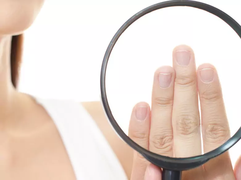 Jakie środki są najskuteczniejsze na grzybicę paznokci?