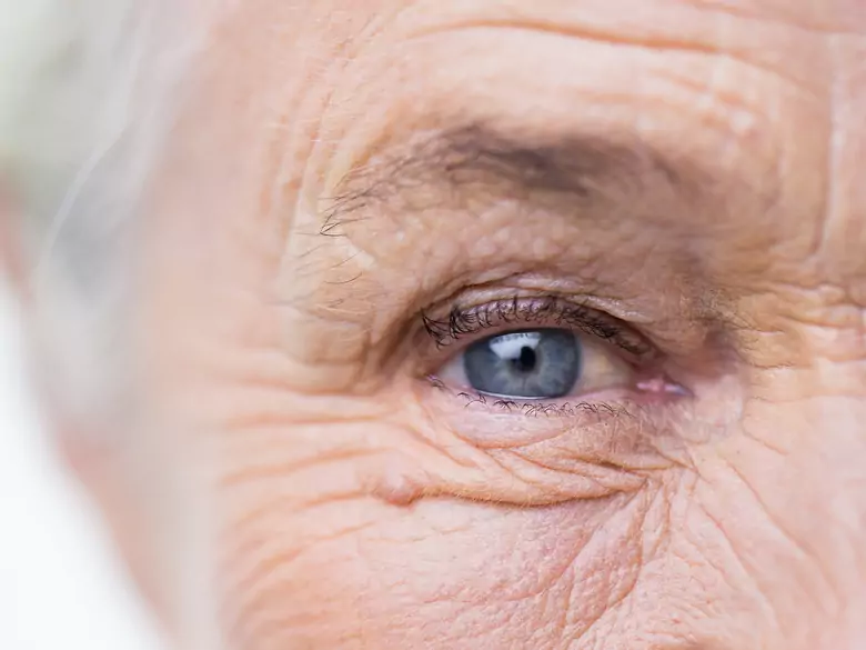 Dermatologiczne aspekty menopauzy - wpływ hormonów