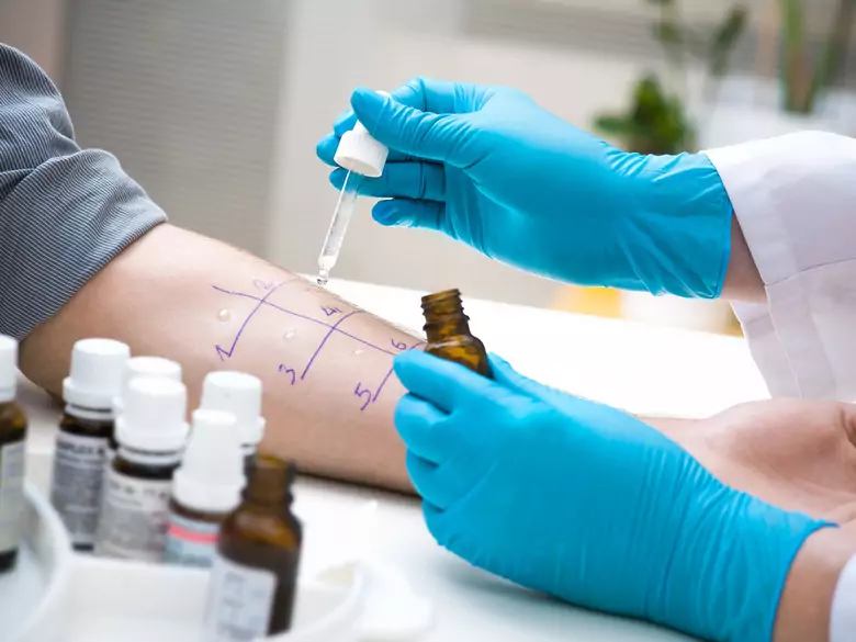 Alergia – irracjonalna walka organizmu