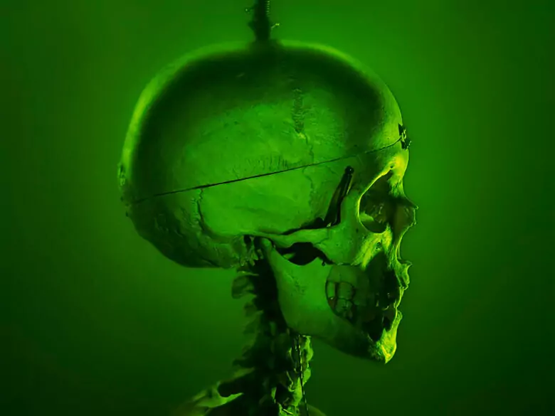 Kiła układu nerwowego - przyczyny, objawy, diagnoza, leczenie