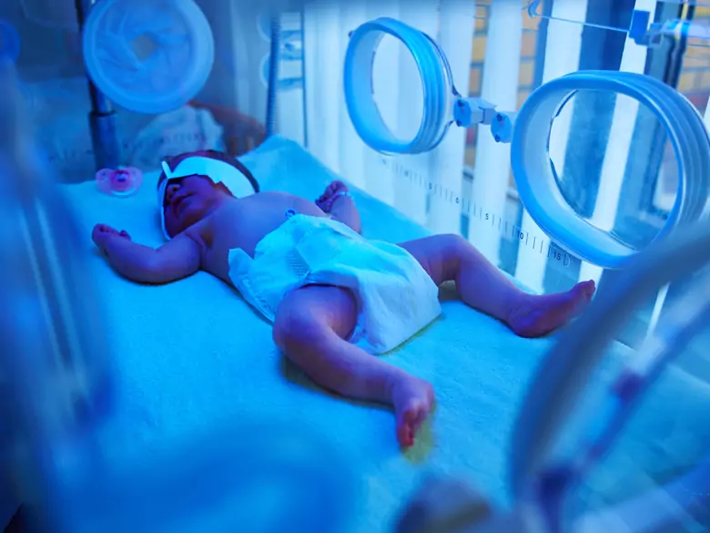 Wykorzystanie fototerapii u dzieci