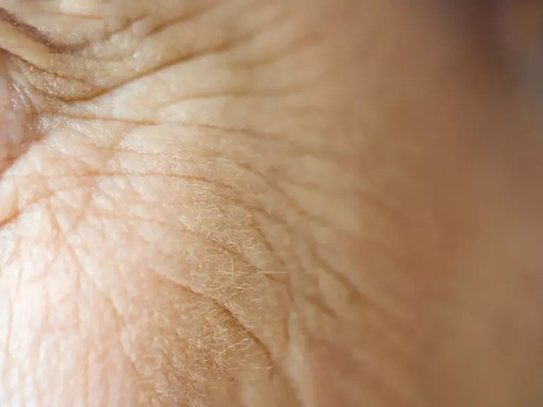 Mniejsza ilość zmarszczek i bardziej jędrna skóra są związane z wcześniejszym rozpoczęciem terapii estrogenowej.